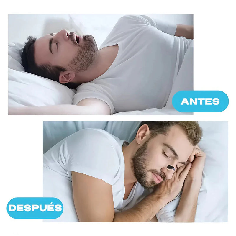 Kit Dilatadores Nasales Magnéticos – Respirá Mejor, Dormí Mejor🍃